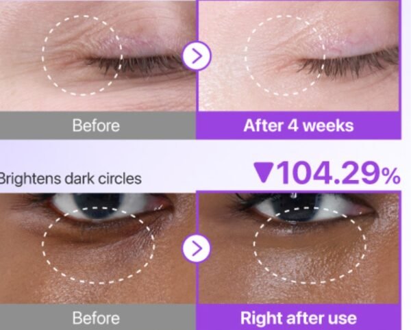 Numbuzin No.9 Eye Cream