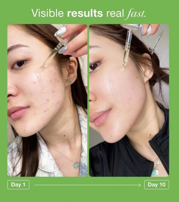 ANUA  | أنوا سيروم الآزليك اسيد المهدئ للبشرة -