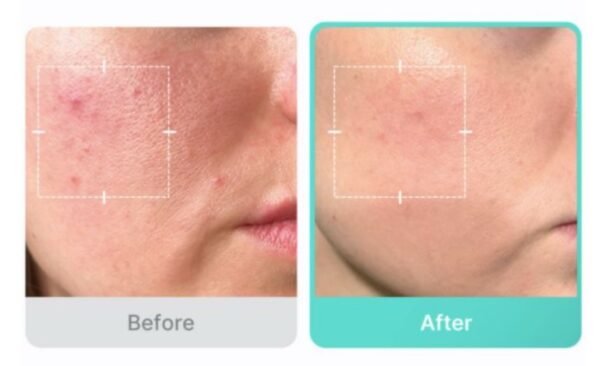 MEDICUBE مديكيوب سيروم مهدئ للبشرة