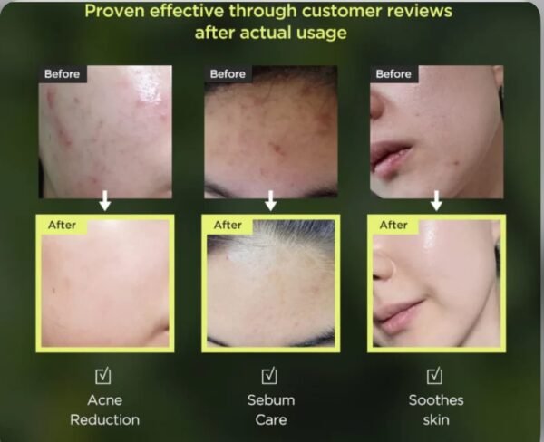 img_0890 ANUA | أنوا تونر مهدئ للبشرة - 250 مل