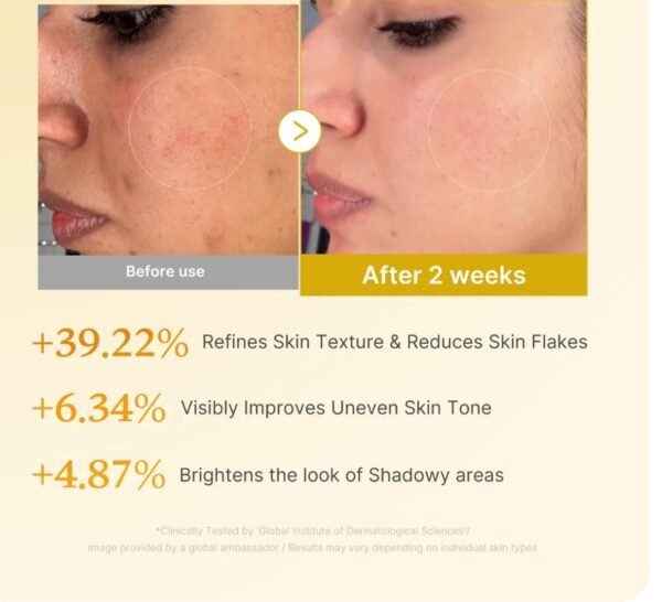 تونر ميديكيوب للتفتيح medicube