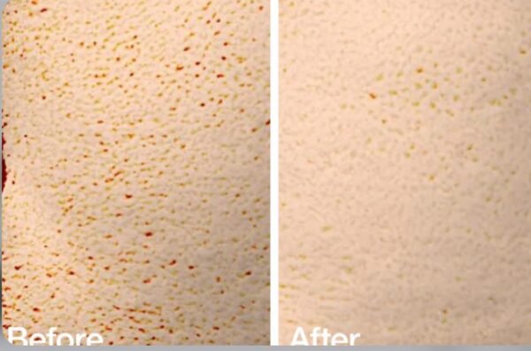 ANUA HEARTLEAF 77% CLEAR PAD - 160ML | أنوا وسادات التونر المائيه