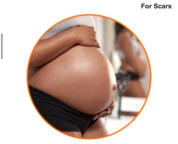 Palmers زيت علاج علامات تمدد الجلد